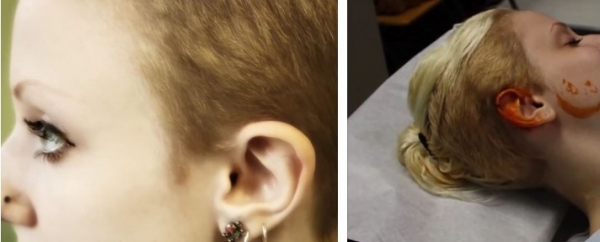 Девушка обрезала уши, чтобы стать эльфом ( 6 фото + видео)
