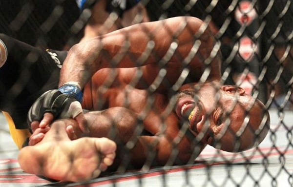 Бойцы MMA бьют так сильно, что порой ломают ноги
