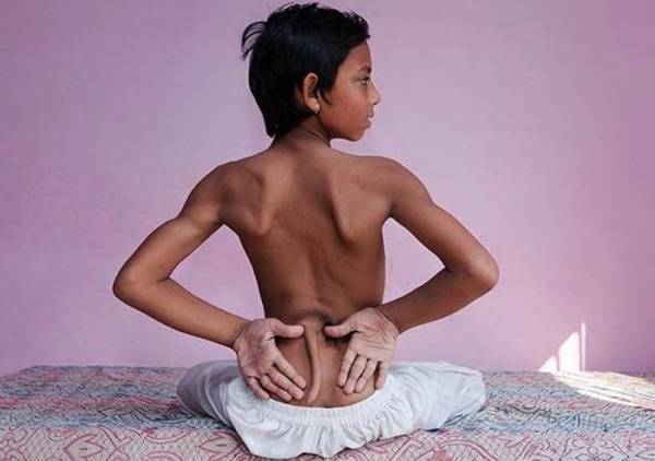 В Индии мальчик с хвостом признан воплощением божества
