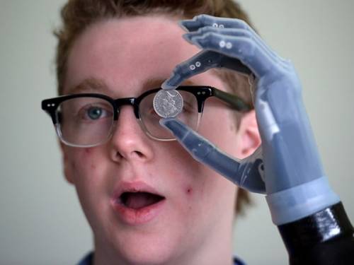 Подросток управляет бионической рукой при помощи смартфона
