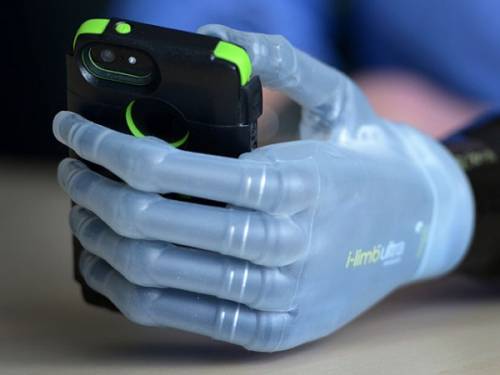 Подросток управляет бионической рукой при помощи смартфона
